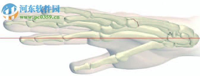 mimics下载 (医学图像处理软件)  附安装教程 17.0 中文破解版