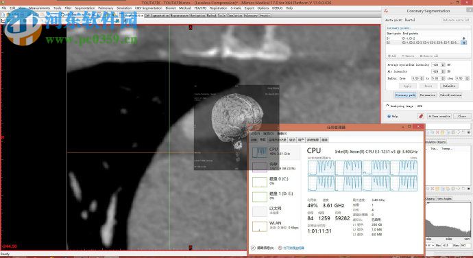 mimics下载 (医学图像处理软件)  附安装教程 17.0 中文破解版