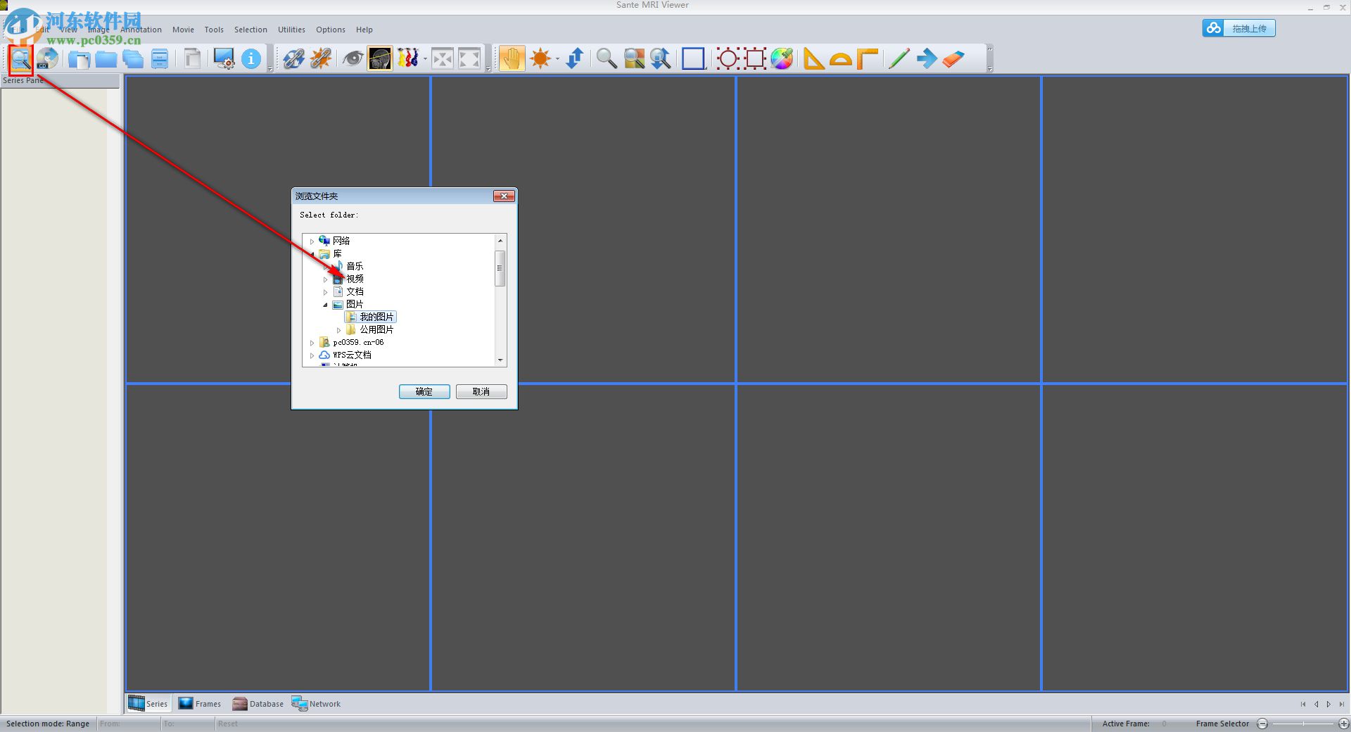 Sante CT Viewer(CT查看软件) 2.2 官方版