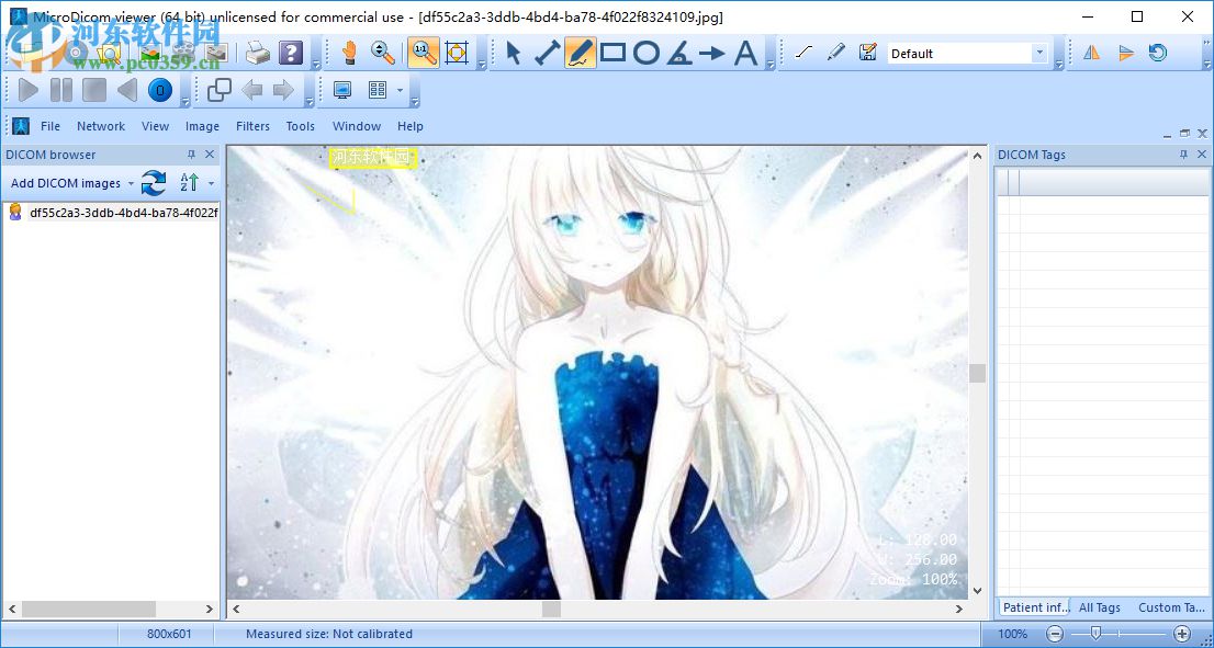 MicroDicom viewer(Dicom格式看图软件) 2.9.2 官方版