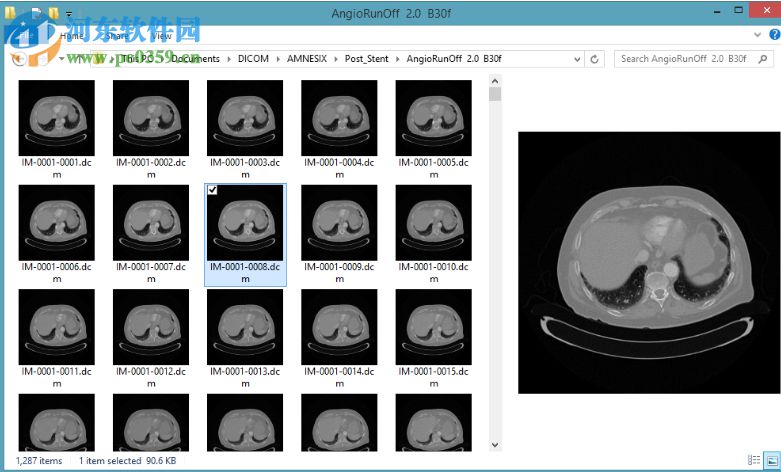 DICOM Thumbnailer(dicom缩略图查看工具) 1.7.0 官方版