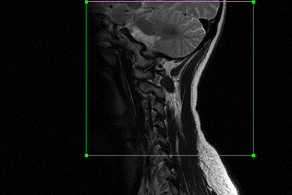 图像测量专家 2018 官方版